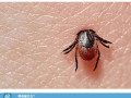 隨州市中心醫(yī)院提醒：小小蜱蟲需警惕！——發(fā)熱伴血小板減少綜合征科普知識