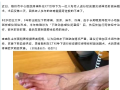 隨州市中心醫(yī)院：八旬老人“老寒腿”獲根治 腰交感神經(jīng)節(jié)射頻消融術(shù)顯奇效